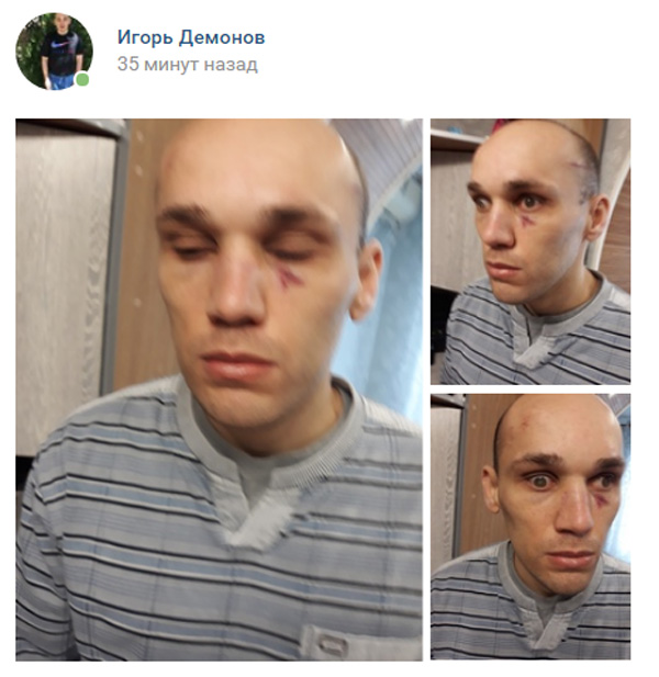 Новый День: Депутат-единоросс от Крыма Шеремет получил плевок и избил обманутого инвалида (ФОТО)