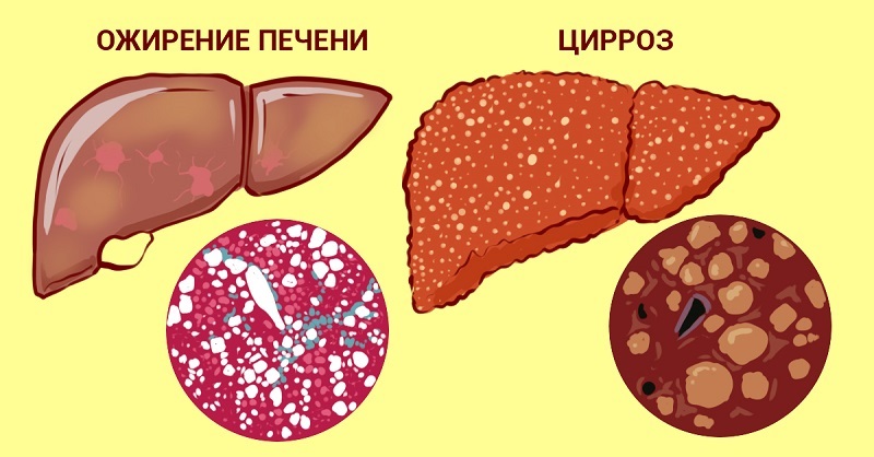 чистка печени свеклой