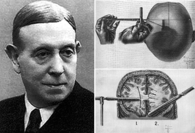 Лоботомия. История потрошения мозгов, или Самая постыдная Нобелевская премия Лоботомия. История потрошения мозгов, или Самая постыдная Нобелевская премия история