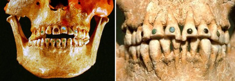 История стоматологии с древнейших времен боль, зубы, история, стоматологи, страх, факты