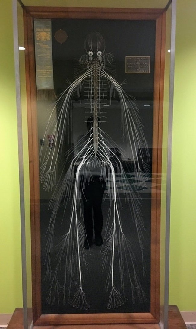 Это первая полная карта нервной системы, извлеченная в 1887 году из тела умершей служанки. Она работала в медицинском колледже Дрексельского университета и завещала свое тело науке. На извлечение ушло несколько сотен часов! необычное, прикол, фото