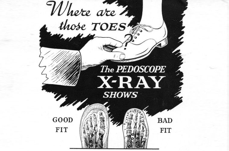 Зачем в первой половине XX века во время примерки обуви ноги просвечивали рентгеном нога, обувь, ренген