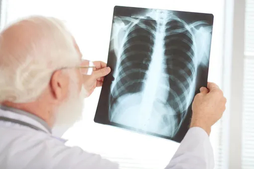 Для диагностики дыхания со свистом рекомендуется сделать рентген грудной клетки
