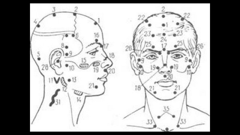 Точки народе. Постановка пиявок на голову схема постановки. Точки постановки пиявок на лице схема. Точки постановки пиявок на голове. Постановка пиявок на голову.