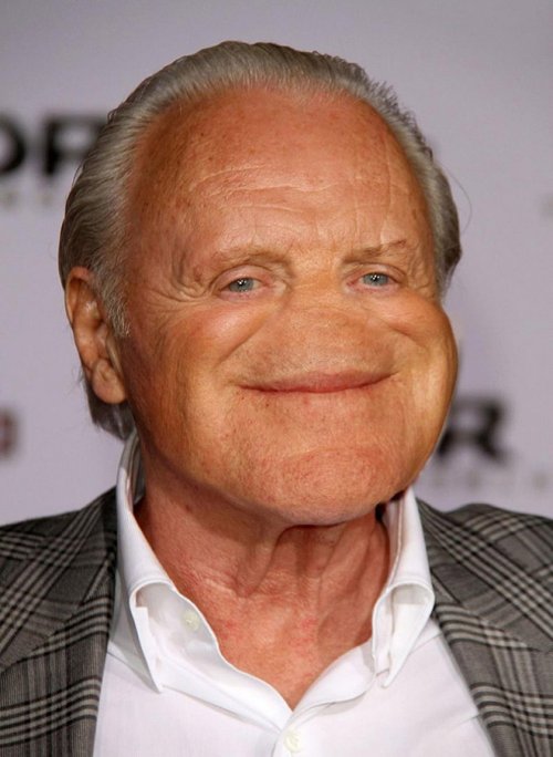 Безносые знаменитости Безносые знаменитости