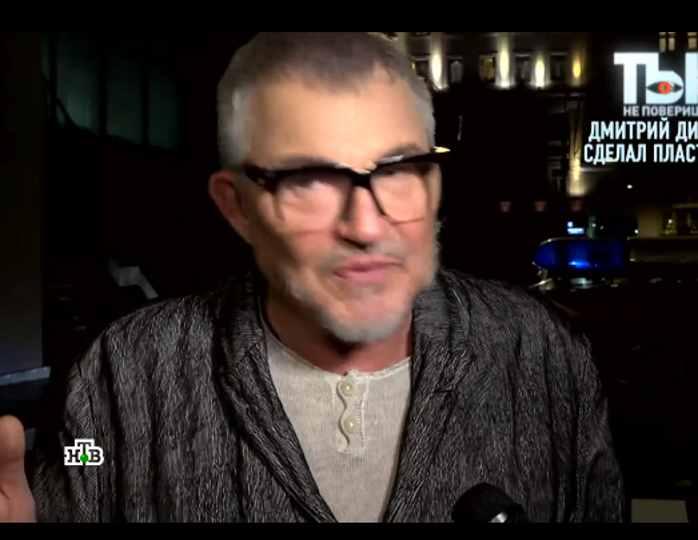 Дмитрий Дибров Фото До И После Пластики