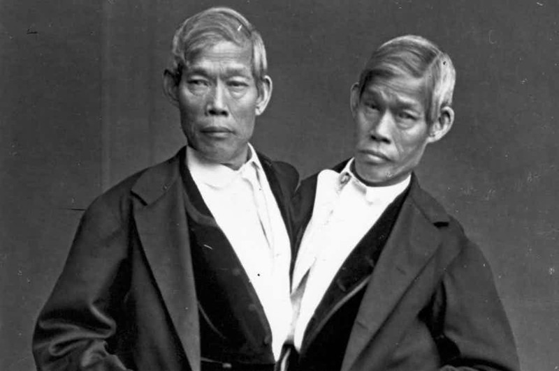 Чанг и Энг - сиамские близнецы инвалиды, история, цирк уродов, шок