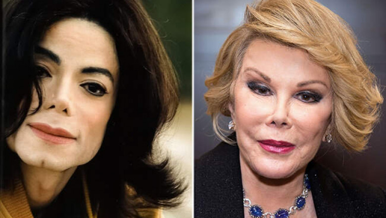 Майкл Джексон, Джоан Риверс и еще 8 знаменитостей, которые стали жертвами пластики в погоне за совершенством