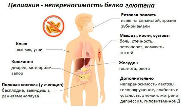 Язва, изжога, регулярный стул: 9 мифов о желудке и пищеварении болезни,гастроэнтерология,желудок,здоровье,мифы,народная медицина,пищеварение,факты