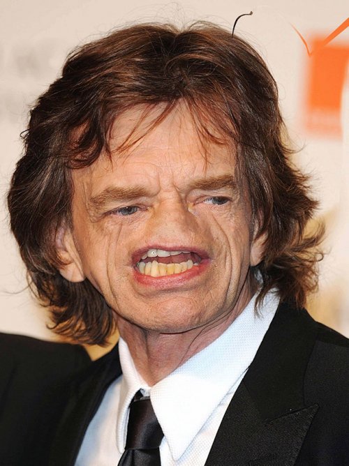 Безносые знаменитости Безносые знаменитости