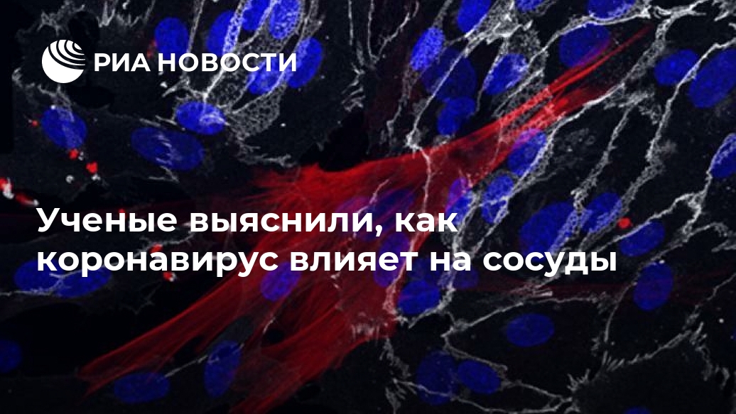 Ученые выяснили, как коронавирус влияет на сосуды белков, сосудов, SARSCoV2, крови, определили, коронавируса, проницаемости, клетки, системы, клеток, эндотелиальных, которые, обнаружили, авторы, кислорода, связаны, эндотелиальные, исследования, COVID19, ученые