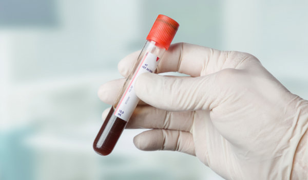 Тест на гепатит С