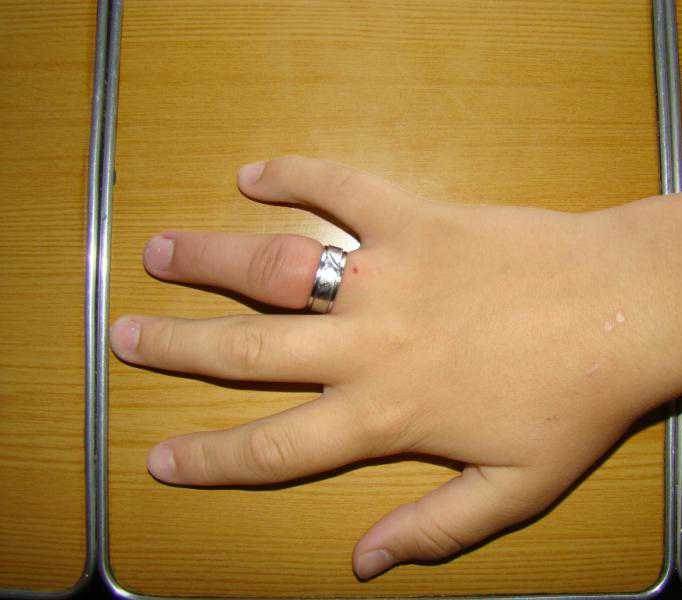 Картинки по запросу Как снять с пальца застрявшее кольцо