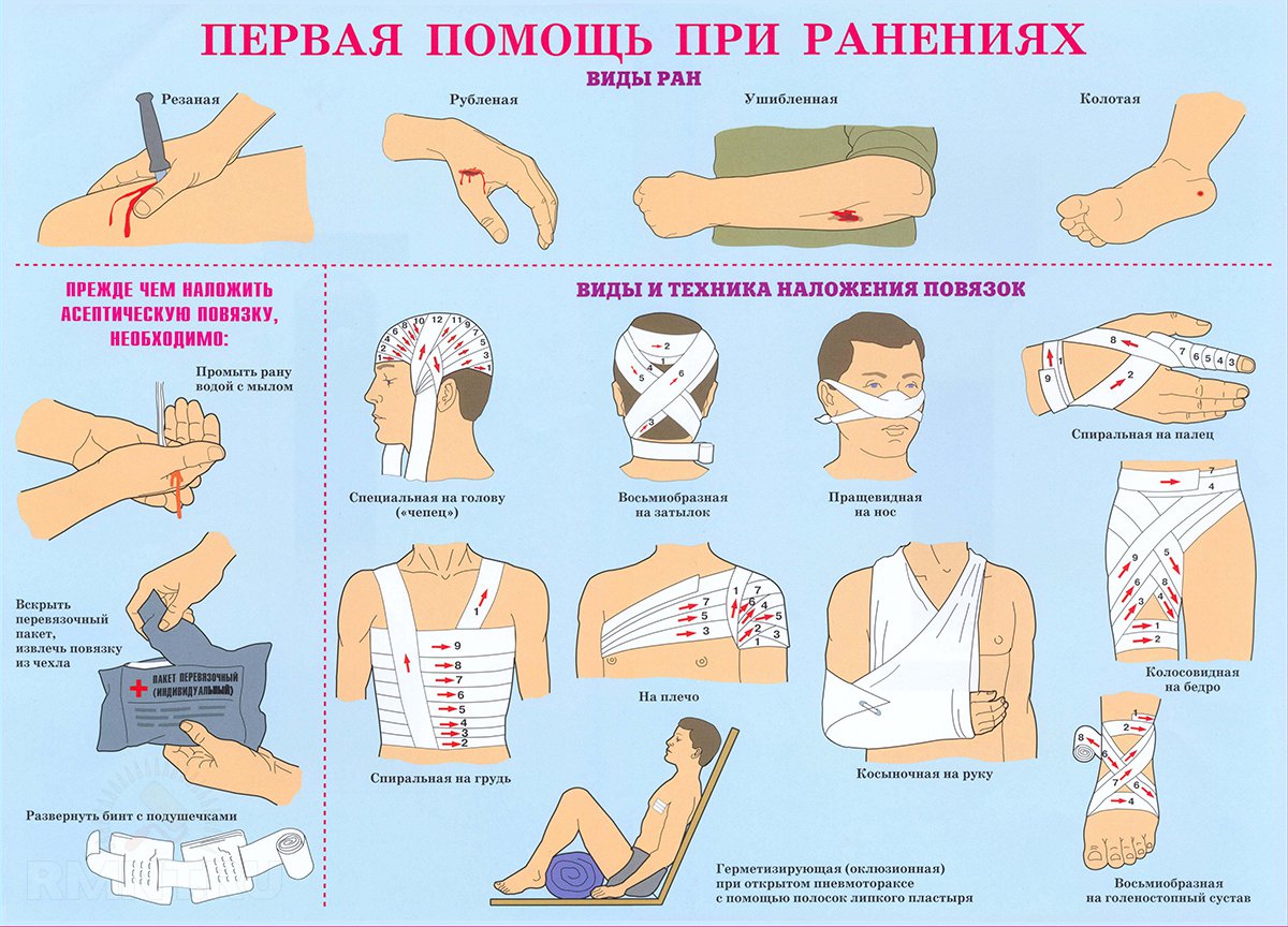 какое положение лучше занять пострадавшему с травмой груди ответ на тест фото 40