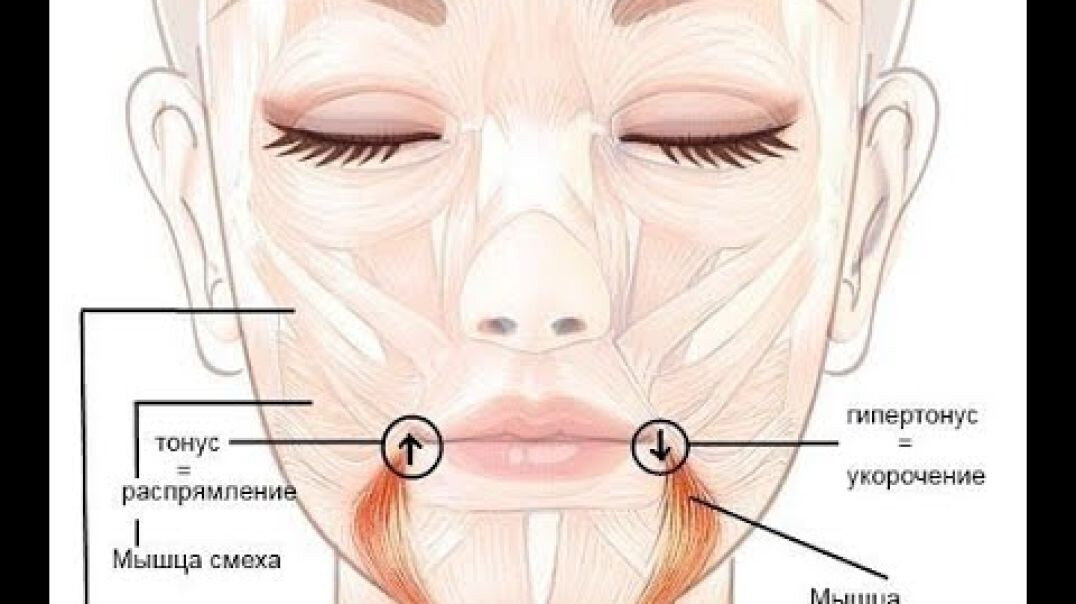Опущенные уголки губ являются одним из самых распространенных "маркеров старения" лица. Они входят в тройку линий, которые формируют на лице так называемую маску грусти и сильно влияют на внешний вид.-3