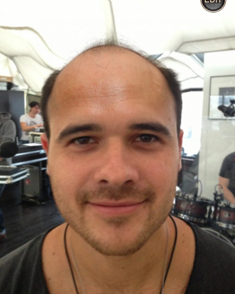 Эмин Агаларов снял парик и продемонстрировал огромную лысину 