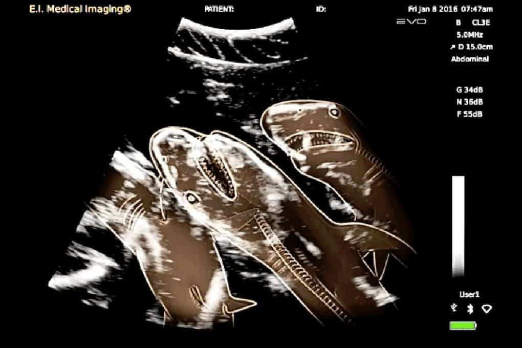 14 захватывающих рентгеновских снимков беременных животных! беременность,животные,интересное,рентгеновские снимки