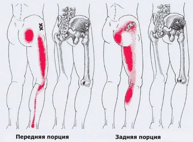 Карта точек боли в теле и точек напряжения мышц (триггеры)