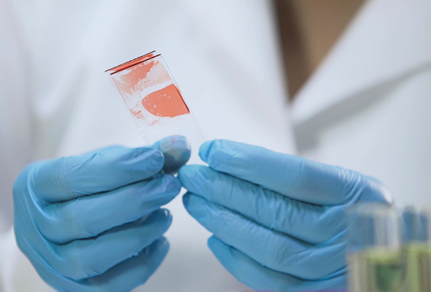 У этих россиян неизлечимая болезнь. Как они живут с ней? болезни,гемофилия,жизнь,здоровье