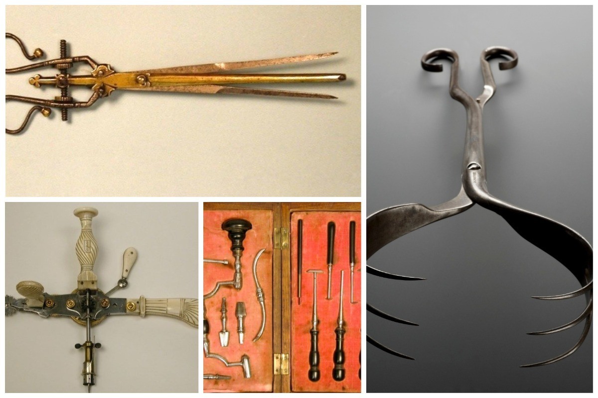 Старинные медицинские инструменты, похожие на орудия пыток