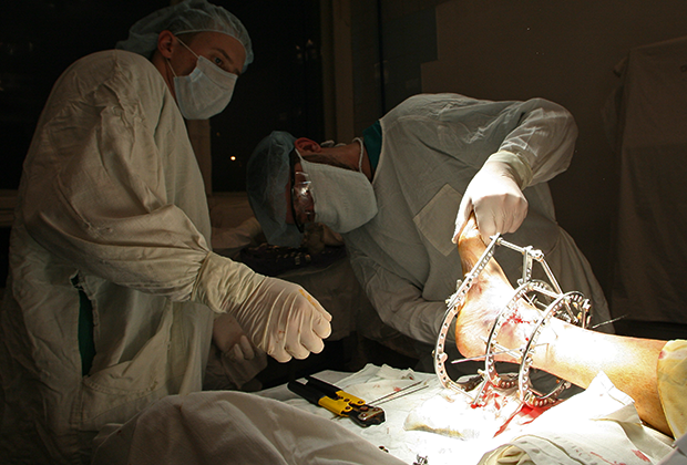 Хирурги проводят операцию по установке аппарата Илизарова на травмированную стопу