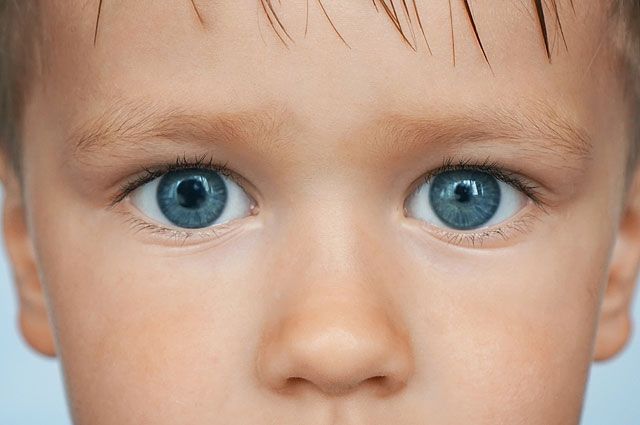 8 аномалий, которые наглядно демонстрируют, как непредсказуема генетика может, глаза, аномалия, пигмента, который, человек, зрачков, имеет, витилиго, людей, всего, волос, именно, делает, передается, несколько, гетерохромия, нерасчесываемых, редкой, болезнью