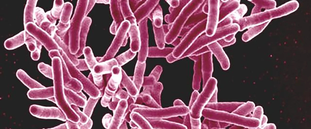 Ученые разрабатывают иммунотерапию против туберкулеза, включая резистентный