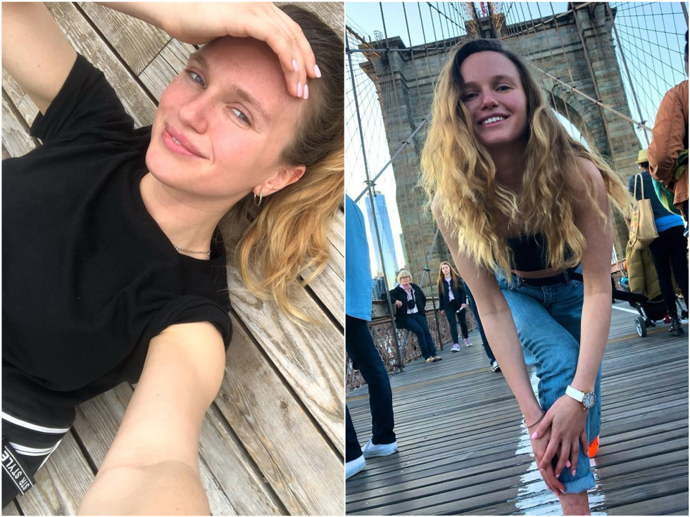 Как сложилась судьба Кати Комлевой, которую залило 90 градусным кипятком