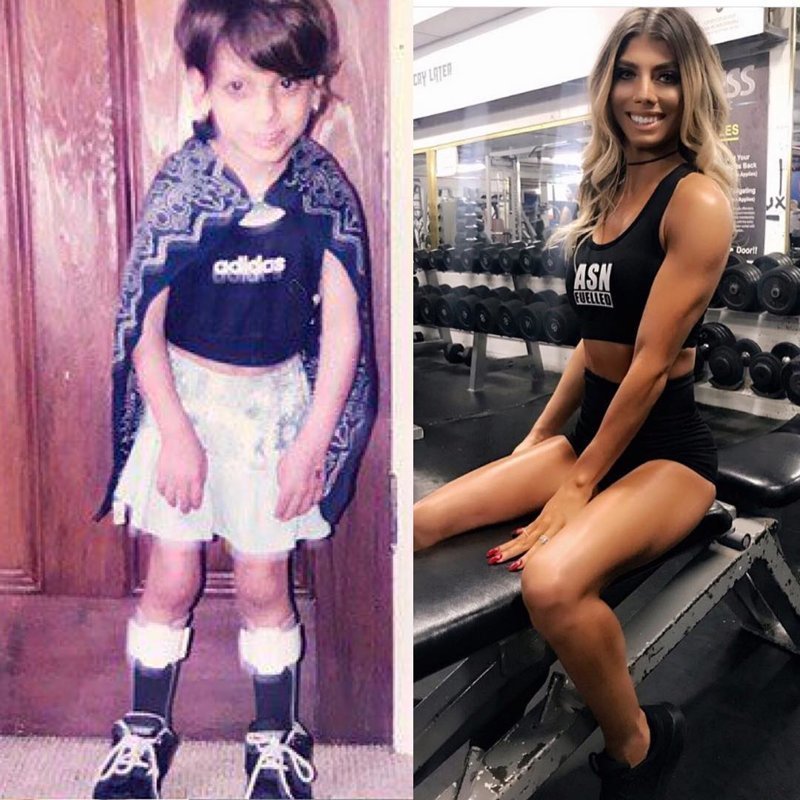 Девушка с церебральным параличом покорила Instagram