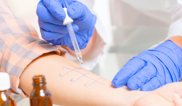 Тест на аллергию