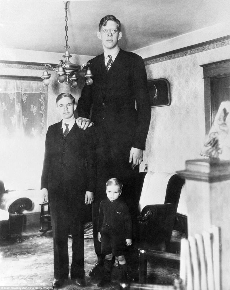 Роберт был старшим из пяти детей. На этом снимке он с двумя младшими братьями в день своего 17-летия акромегалия, великан, опухоль, рекорд, рекорд гиннесса, рекордсмен Гинесса, самый высокий, самый высокий человек