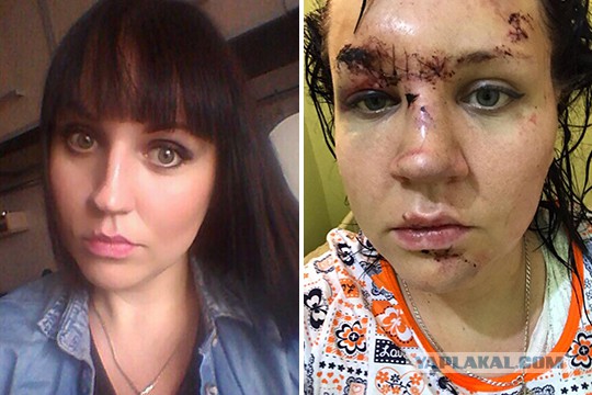 «Не сработала ни одна из подушек безопасности»: как пара из Нижнекамска судится с Hyundai аварии,авто и мото,автоновости