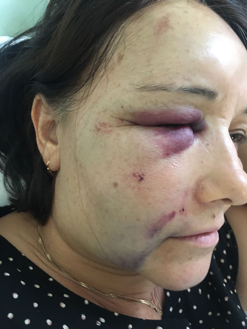 "ЕСЛИ НАС ПРИЕДУТ УБИВАТЬ, НИКТО НЕ СПАСЁТ": КАВКАЗЦЫ-РЭКЕТИРЫ ТЕРРОРИЗИРУЮТ СЕМЬЮ В ПОДМОСКОВЬЕ "ЕСЛИ НАС ПРИЕДУТ УБИВАТЬ, НИКТО НЕ СПАСЁТ": КАВКАЗЦЫ-РЭКЕТИРЫ ТЕРРОРИЗИРУЮТ СЕМЬЮ В ПОДМОСКОВЬЕ россия