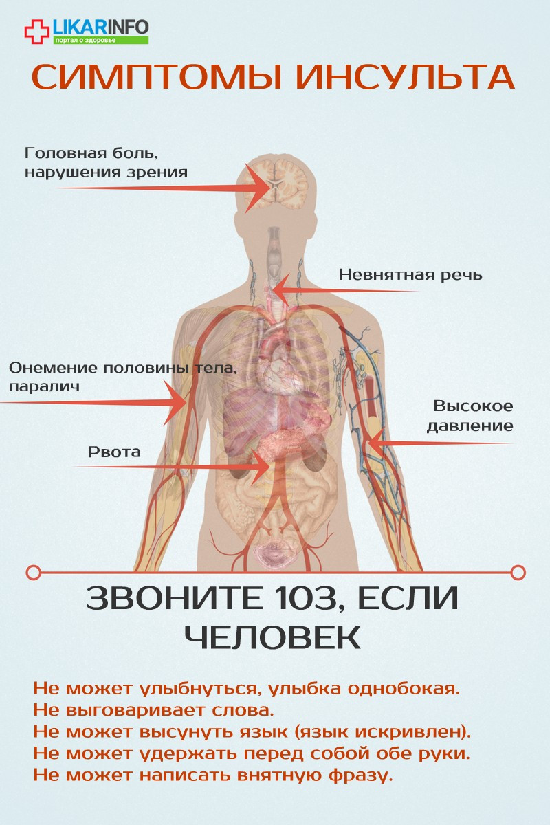 Что такое инсульт и почему он возникает? болезни,инсульт,медицина