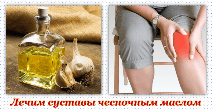 Лечение артроза суставов чесночным маслом