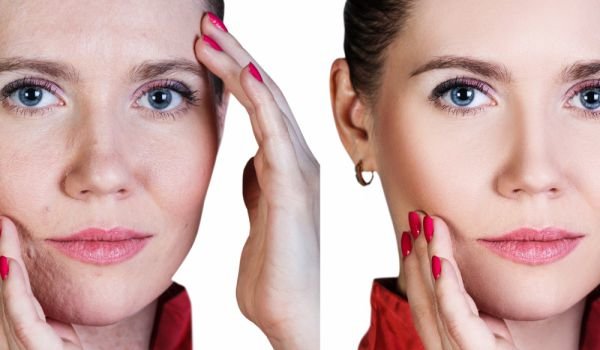 Противовозрастные средства