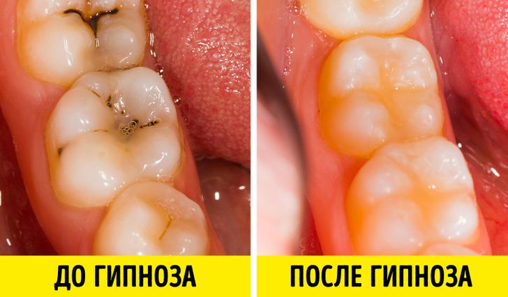 15 научных фактов о гипнозе, которые отличают его от любых эзотерических практик чтобы, можно, когда, гипноз, человека, состояние, гипноза, людей, используют, помогает, использовать, после, жертвы, происходит, будет, которые, образом, информацию, такое, который