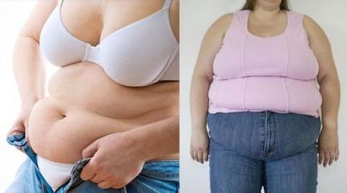 Может ли гормональный фон стать причиной набора веса. Анализы на гормоны при ожирении 03