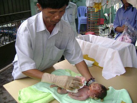 Отец из Вьетнама спасает сотни малышей от абортов.