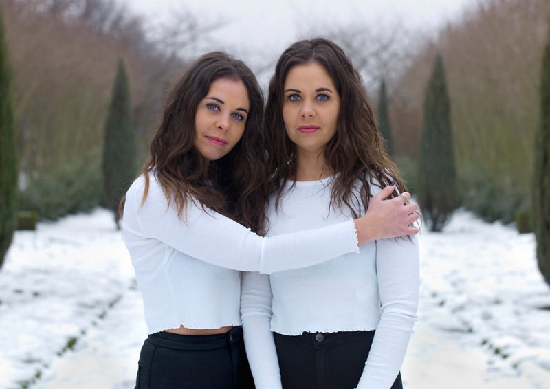 «Сходства и различия»: мощный фотопроект о непохожести однояйцевых близнецов