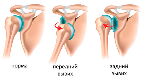 Симптоматика травмы