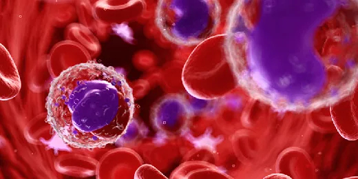 Почему показатель лимфоцитов повышен и как с этим поступить