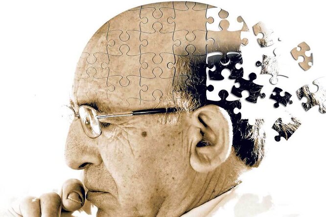 Что такое болезнь Альцгеймера и почему ей болеет так много людей