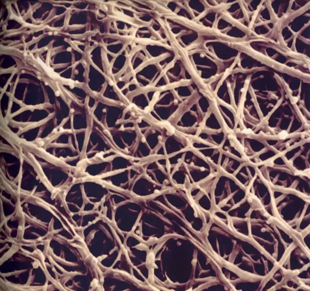 Так выглядит скорлупа яйца под микроскопом. Уже не выглядит такой непроницаемой, правда? 