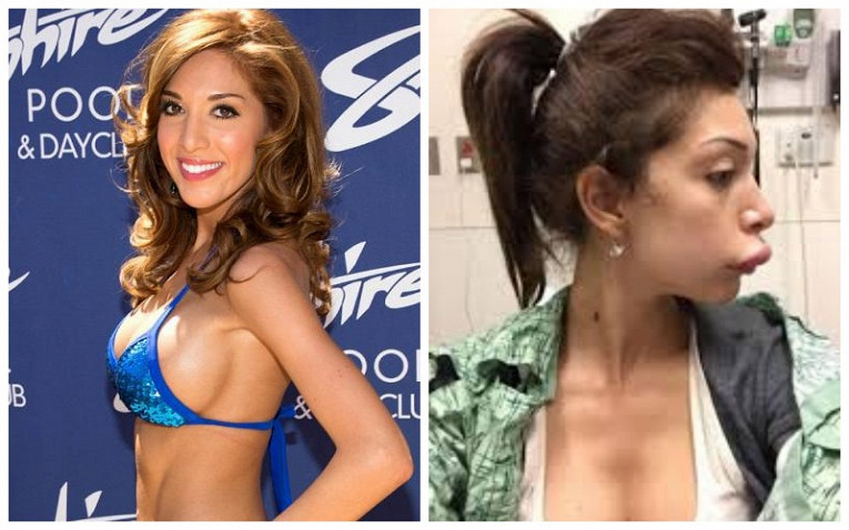 Знаменитости, пожалевшие о том, что сделали пластику Знаменитости, пожалевшие о том, что сделали пластику образ