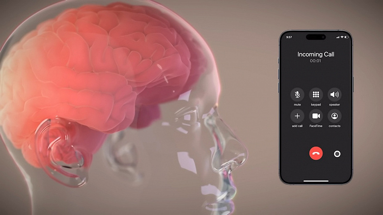 Neuralink запускает клиническое исследование перевода мыслей в текст в октябре