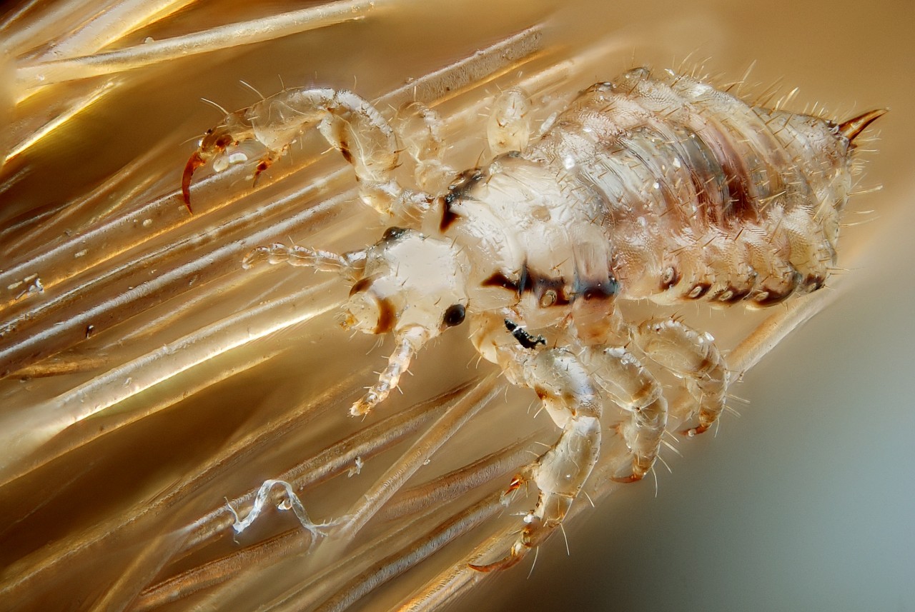 Male human head louse, Pediculus humanus capitis. Technical settings : - focus stack of 57 images - microscope objective (Nikon achromatic 10x 160/0.25) directly on the body (with adapter ~30 mm)