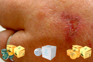 Крем-воск «ЗДОРОВ» против дерматита