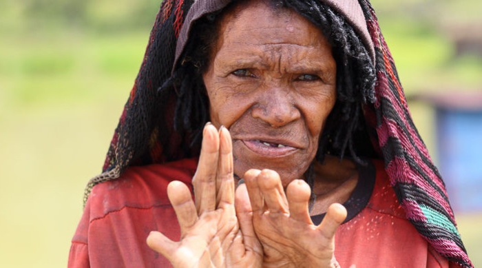 Теряя родственников, женщины отрубали себе пальцы. | Фото: cdn.fishki.net.
