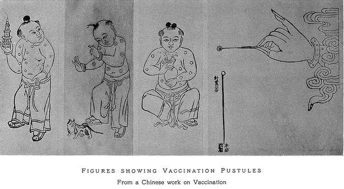 Прививки прошлого — что мы знаем о вакцинах?  болезни, вакцинация,медицина, эпидемия